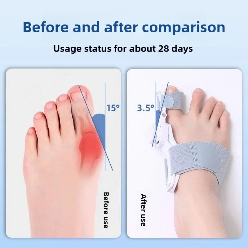 Bunion Corrector Unisex Big Toe Orthopedic Toe Straightener Anti-Slip Heel Strap for Left & Right Feet Rotatable Toe Separator